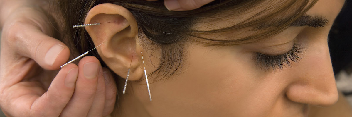 Ear-acupuncture